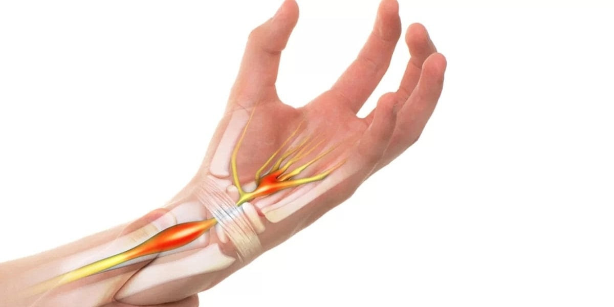 End Neuropathy Pain Without Drugs or Surgery